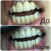 Стоматология «Диамонд Дентс»