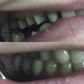 Стоматология «Дантист» на Хиросимы