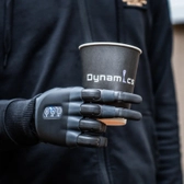 Динамика | Центр протезирования нижних и верхних конечностей, центр реабилитации