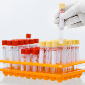 Лабдиагностика на Парковом