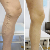 Брянский флебологический центр