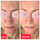 Косметология «Нефертити»