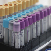 «Центр ЭКО»