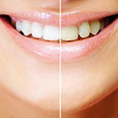 Стоматология «ЭкоДент»