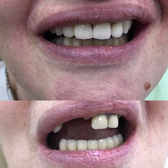 Стома Нева, Выездная стоматология