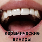 Смайл на Татарской