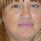 Парфенова Людмила Ильинична, гинеколог