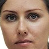 Орловская Татьяна Алексеевна, офтальмолог