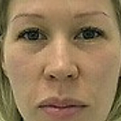 Гайворонская Анна Константиновна, гематолог