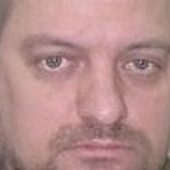 Яновский Александр Викторович, торакальный хирург