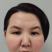 Касымова Асель Жоомартовна, дерматолог