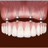 Аркадьев Василий петрович, абдоминальный хирург