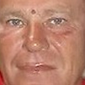 Кутузов Игорь Владимирович, нарколог