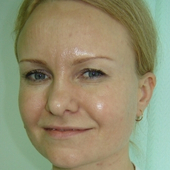 Лазарева Ольга Валерьевна, ортопед