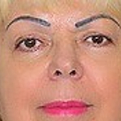 Ястребова Наталья Дмитриевна, фтизиатр