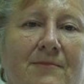 Евстифеева Наталья Михайловна, терапевт