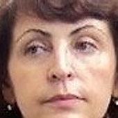 Смоляренко Е. В., офтальмолог