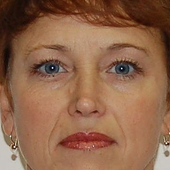 Моржакова Марина Сергеевна, анестезиолог