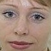 Платунова Татьяна Анатольевна, анестезиолог-реаниматолог