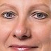 Шатохина Татьяна Алексеевна, стоматолог-терапевт