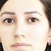 Игнатьева Анастасия Александровна, терапевт