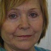 Латышева Людмила Андреевна, гинеколог