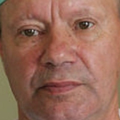 Брагин Николай Михайлович, анестезиолог