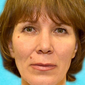 Ванина Ирина Владимировна, терапевт