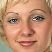 Березина Ирина Анатольевна, сосудистый хирург