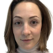 Попова Евгения Михайловна, эндоскопист