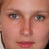 Брусницына Елена Викторовна, стоматолог-терапевт