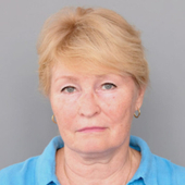 Явнова Татьяна Владимировна, ЛОР