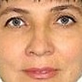 Буяновская Ольга Вячеславовна, стоматолог-хирург