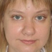 Спиридонова Алла Владимировна, рентгенолог