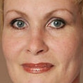 Кузьминская Татьяна Александровна, офтальмолог