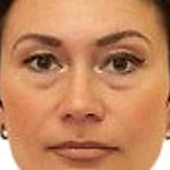 Парфенова Анастасия Рудольфовна, радиолог