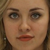 Белякова-Швецова Екатерина Сергеевна, дерматолог