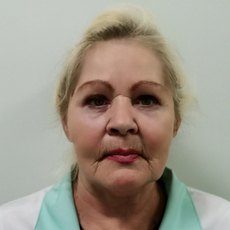 Полоус Галина Анатольевна, невролог