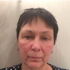 Никитина Татьяна Борисовна, офтальмолог