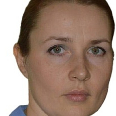 Ивченко Нина Владимировна, невролог