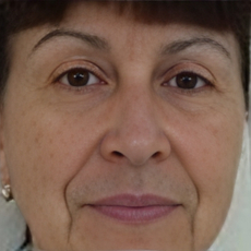 Шипоренко Татьяна Иосифовна, стоматолог-терапевт