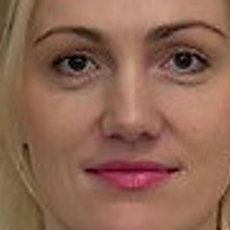 Ружникова Анна Алексеевна, онколог