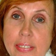 Бурова Елена Михайловна, стоматолог-терапевт