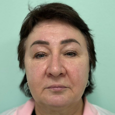 Шубина Надежда Петровна, детский ЛОР