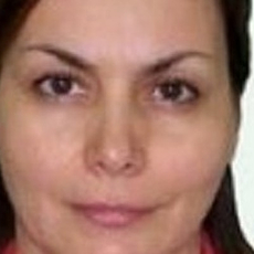 Чичкина Оксана Алексеевна, детский невролог