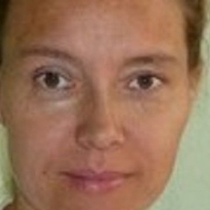 Хафизова Зухра Анваровна, хирург