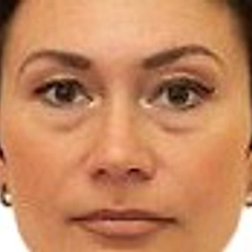 Парфенова Анастасия Рудольфовна, рентгенолог