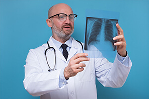 Перелом ребер