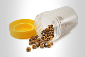 Камни в мочевом пузыре