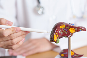 Цирроз печени